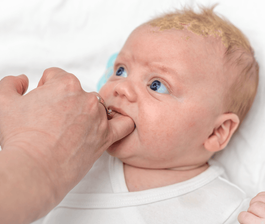 Cradle Cap: a visual guide - T is for Tame