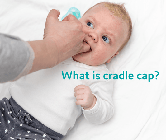 Cradle Cap: What it is? Where does it occur? How do you treat it? - T is for Tame