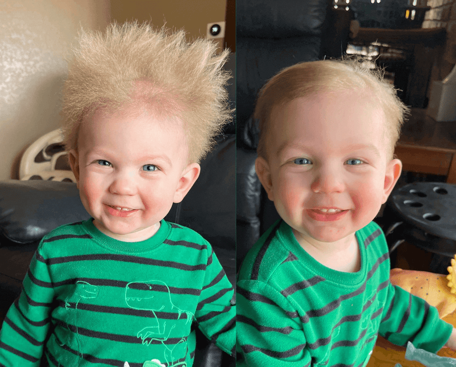 Static