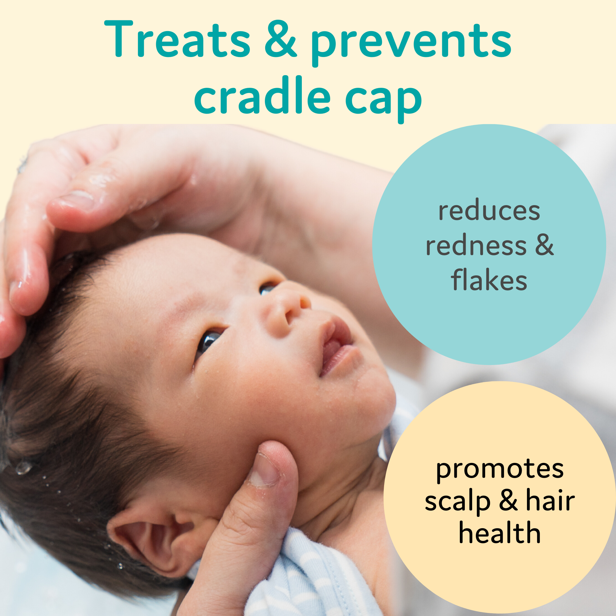 Baby Natural Exfoliant & Nourishing Taming Balm for Cradle Cap, Dry Scalp & Skin, Made in the USA - 1.6 fl oz